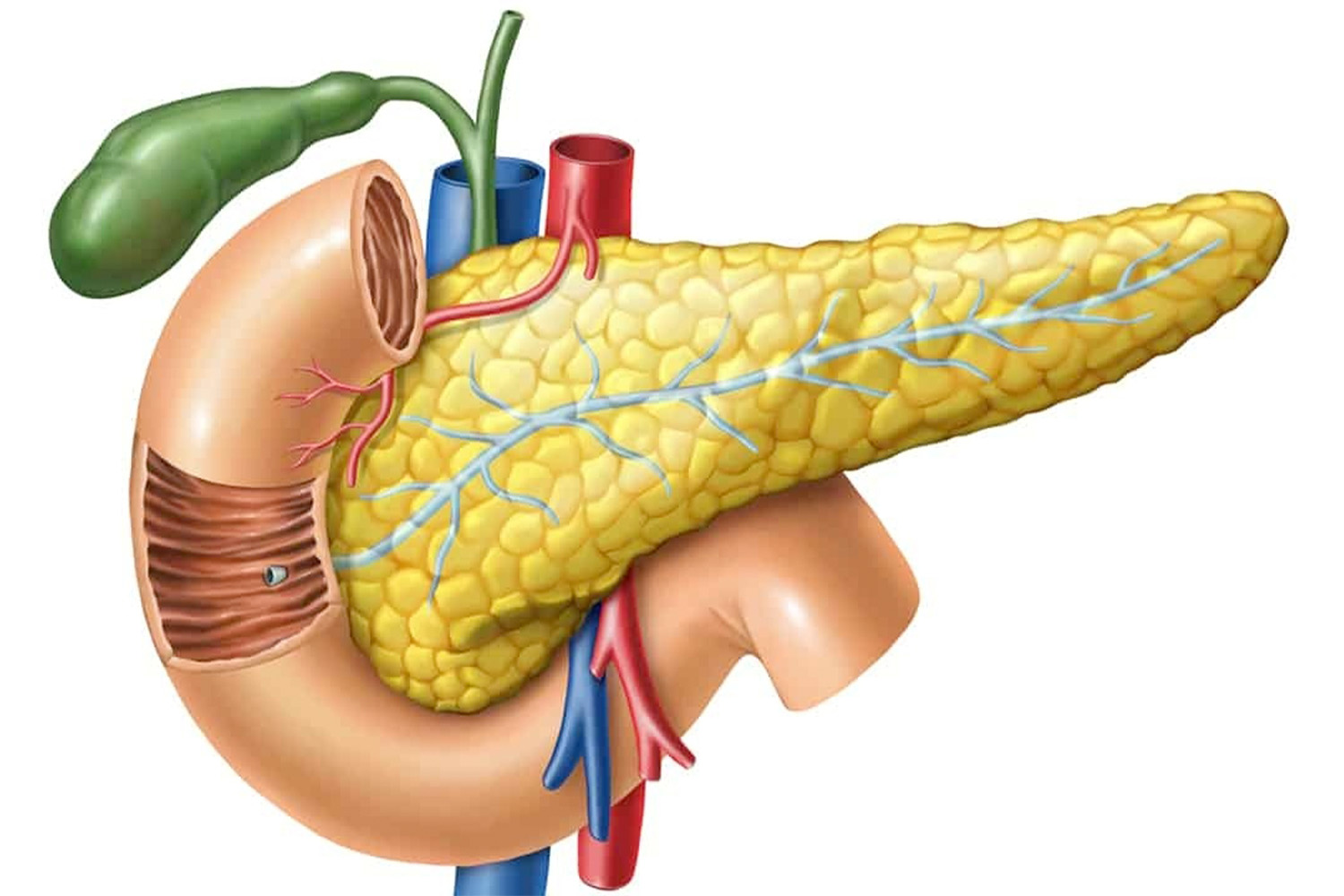 Acute Pancreatitis