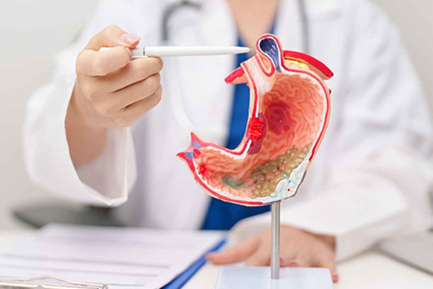 GERD & Chronic Acidity